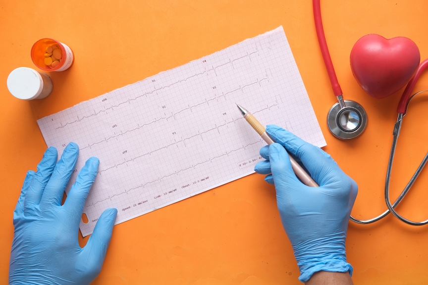 Health check-ups